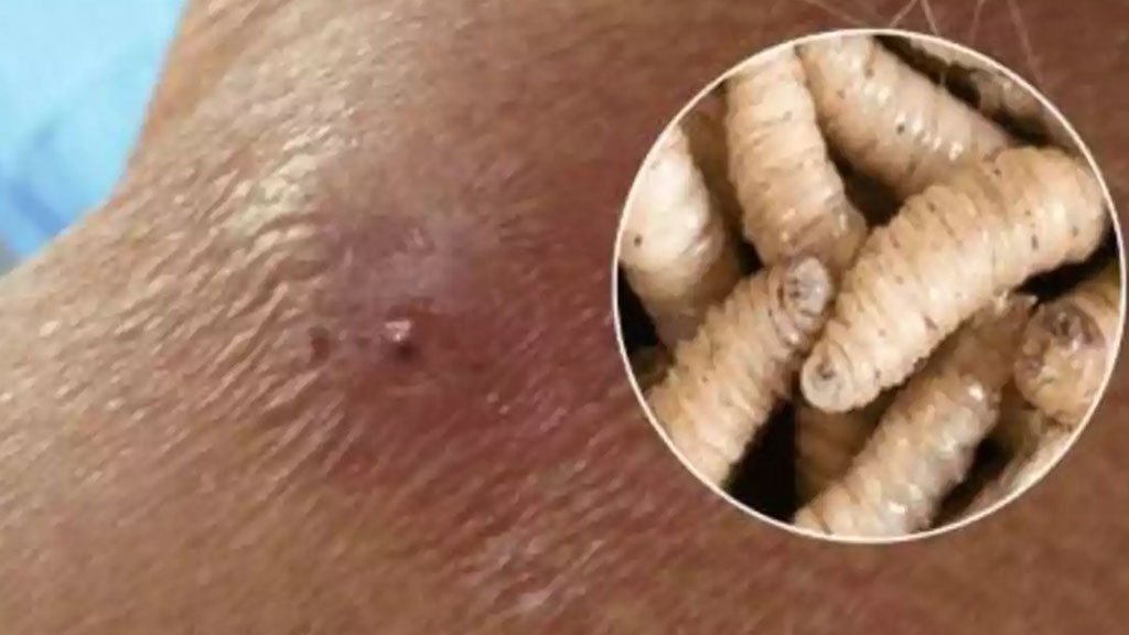 Screwworms